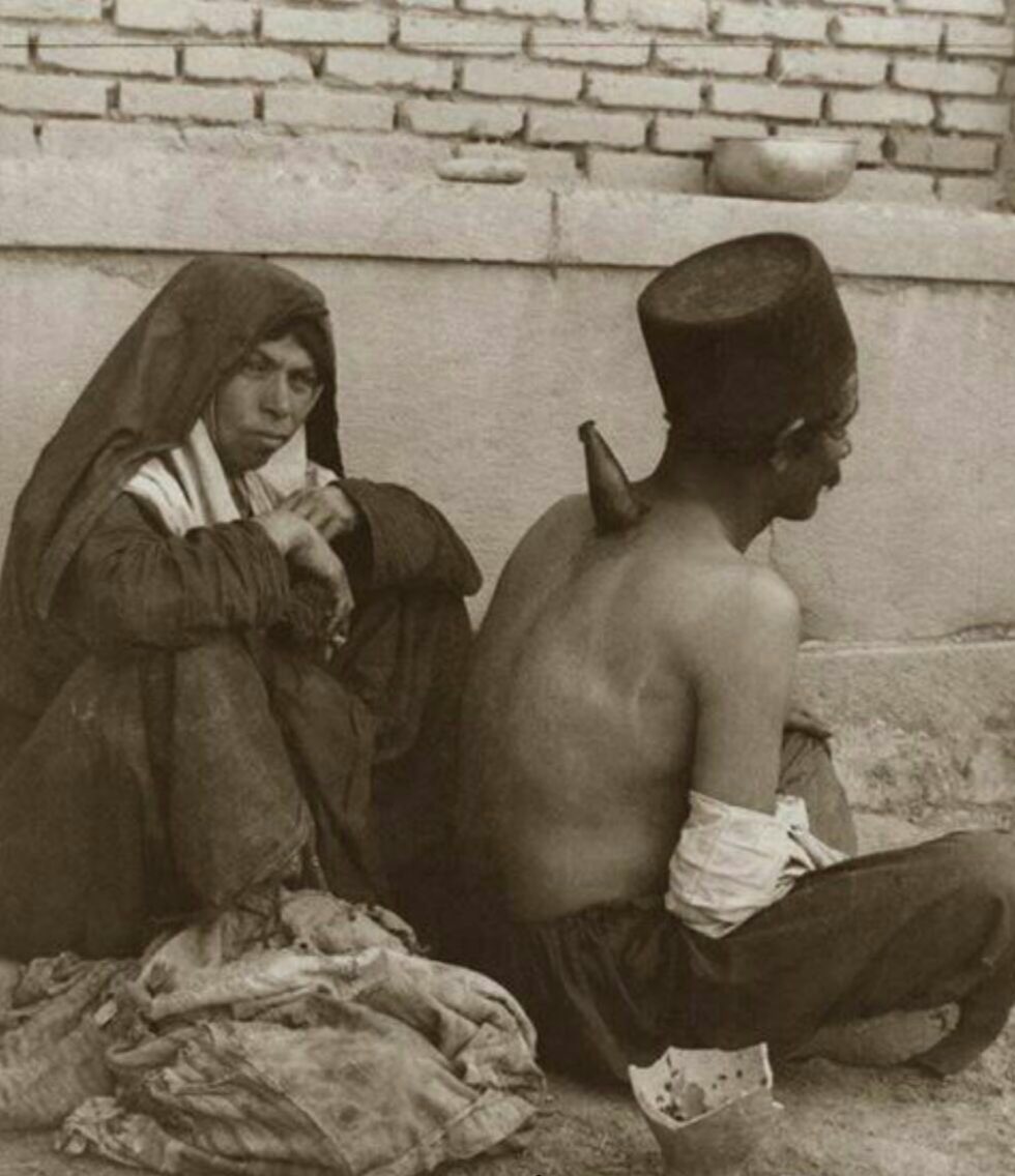 حجامت در دوران قاجار