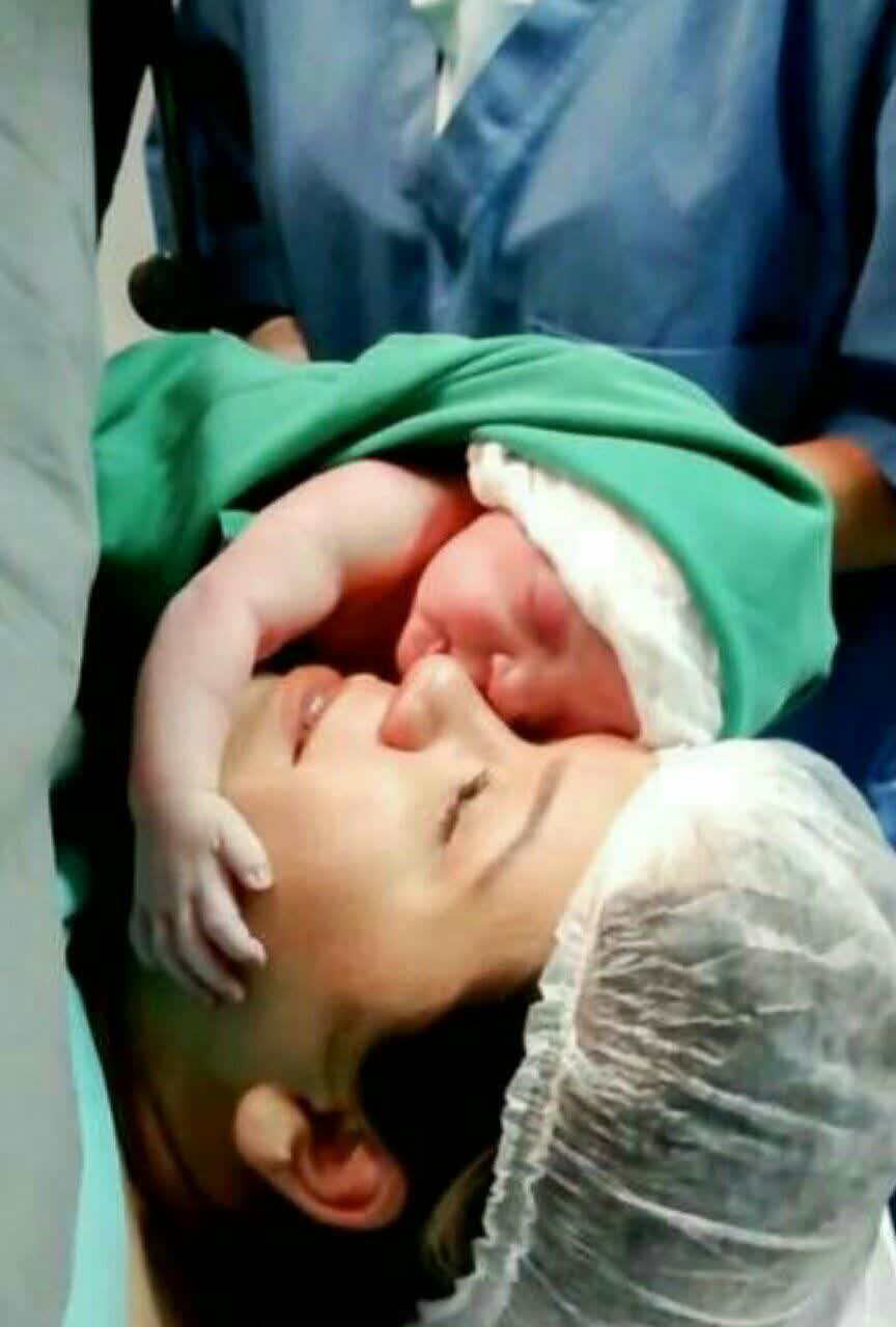 حرکت جالب نوزاد بعدازلخظه تولد