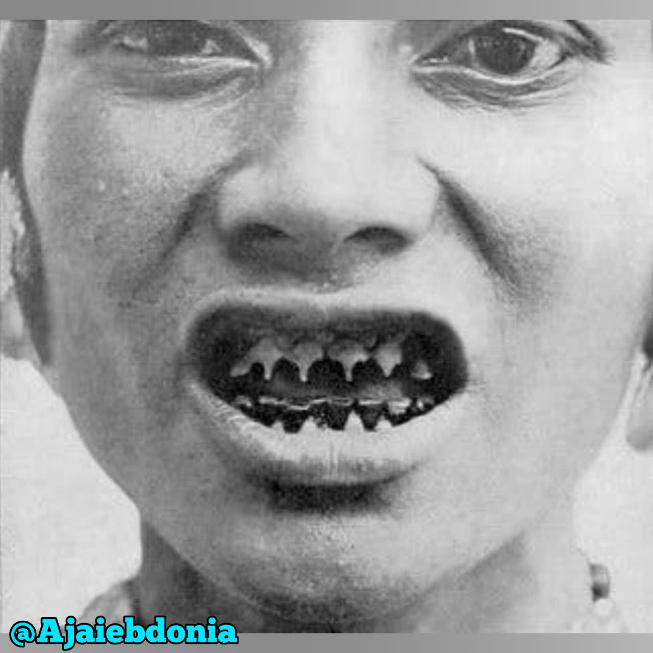 نوك تيز كردن دندان ها