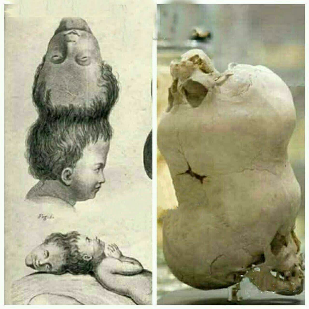 دو سر روی هم