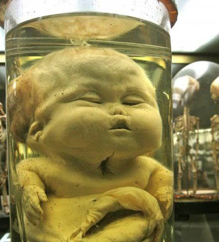 موزه بسیار عجیب دوپوترن فرانسه