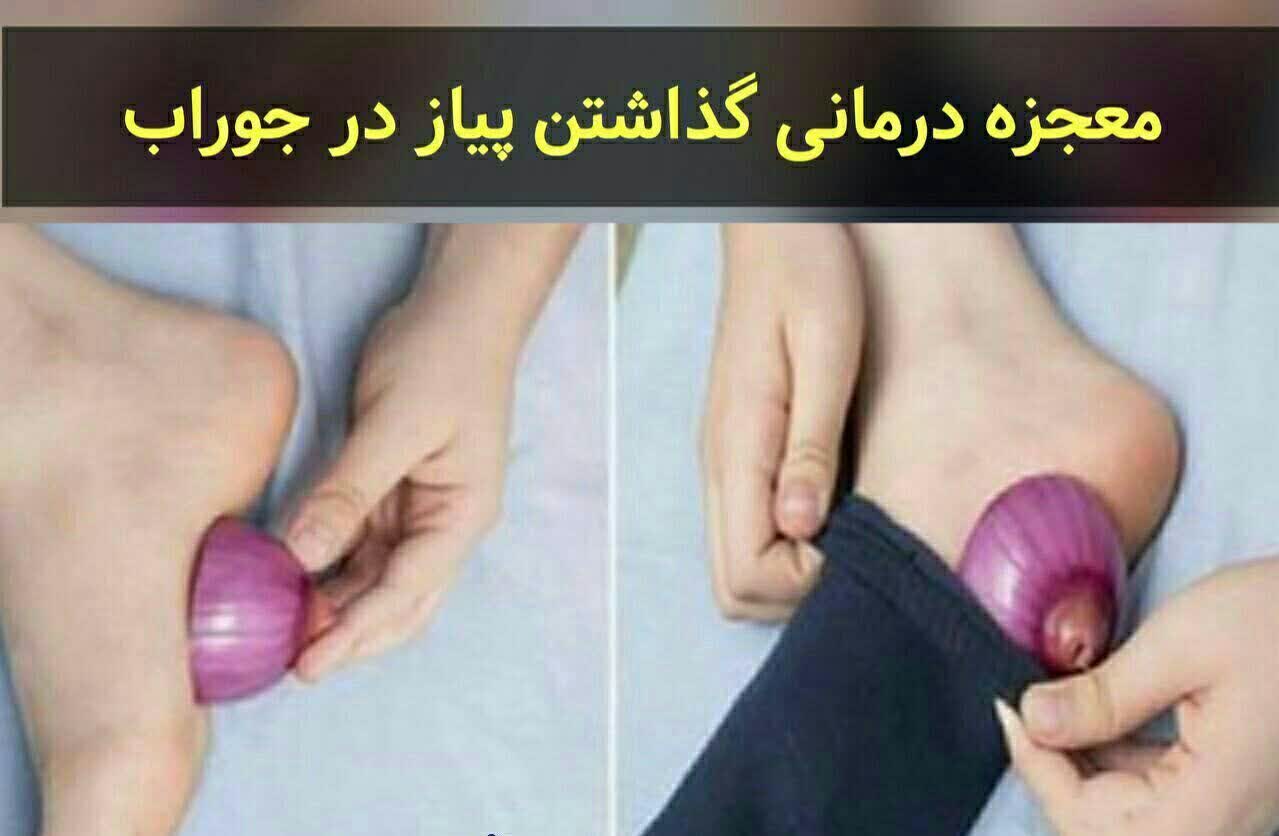 نابود تب با پیاز