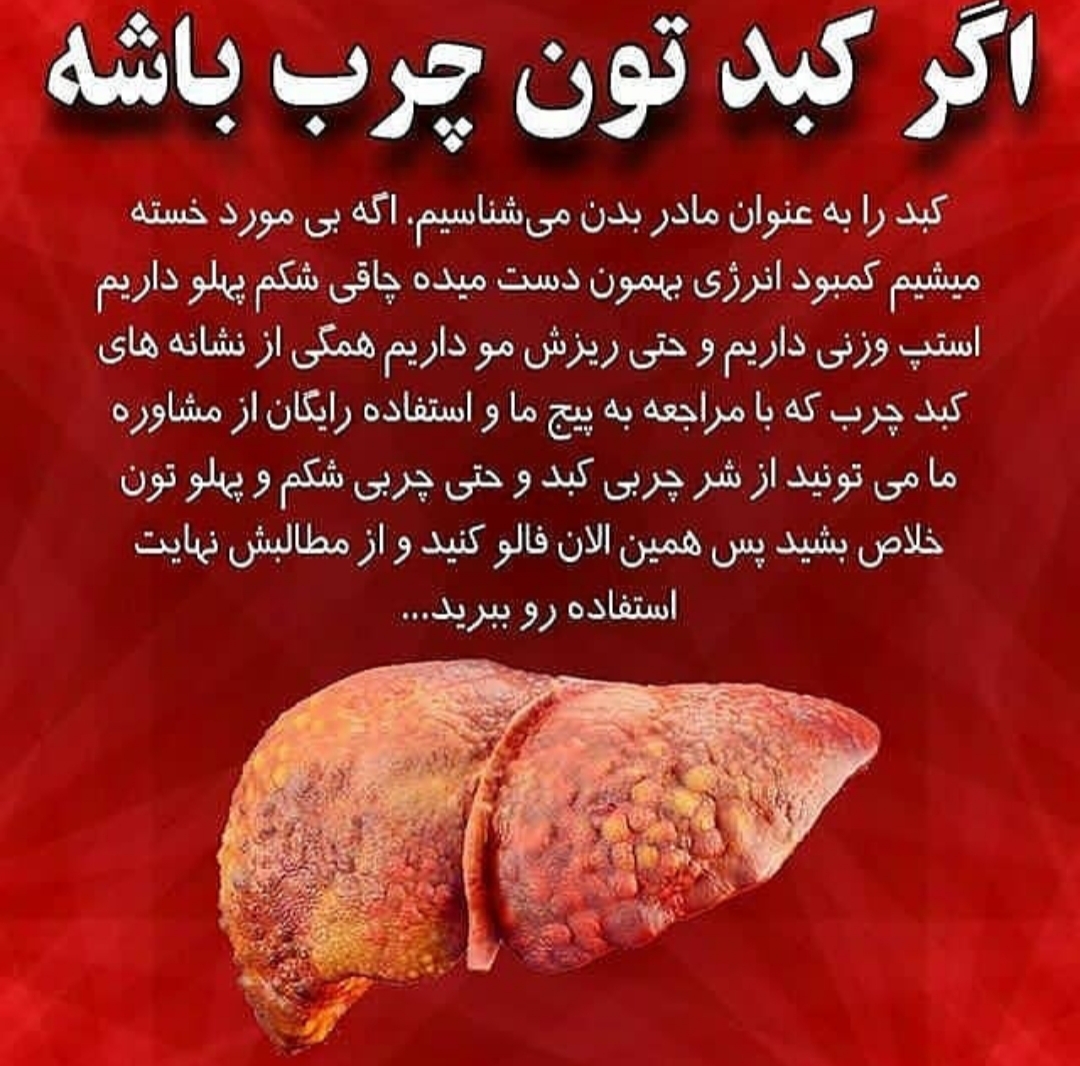 علایم کبد چرب 