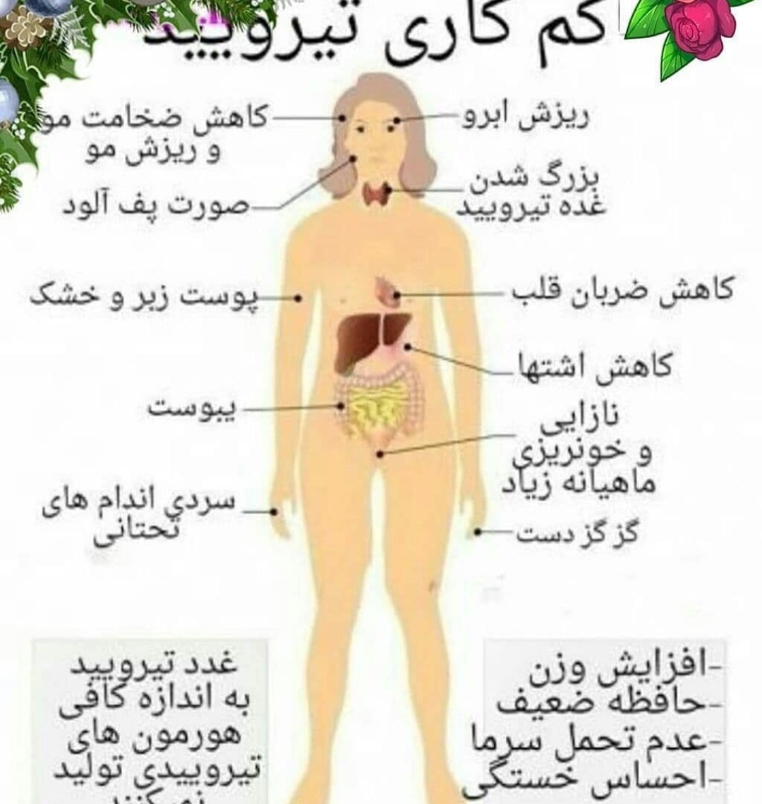 کم کاری تیروئید 