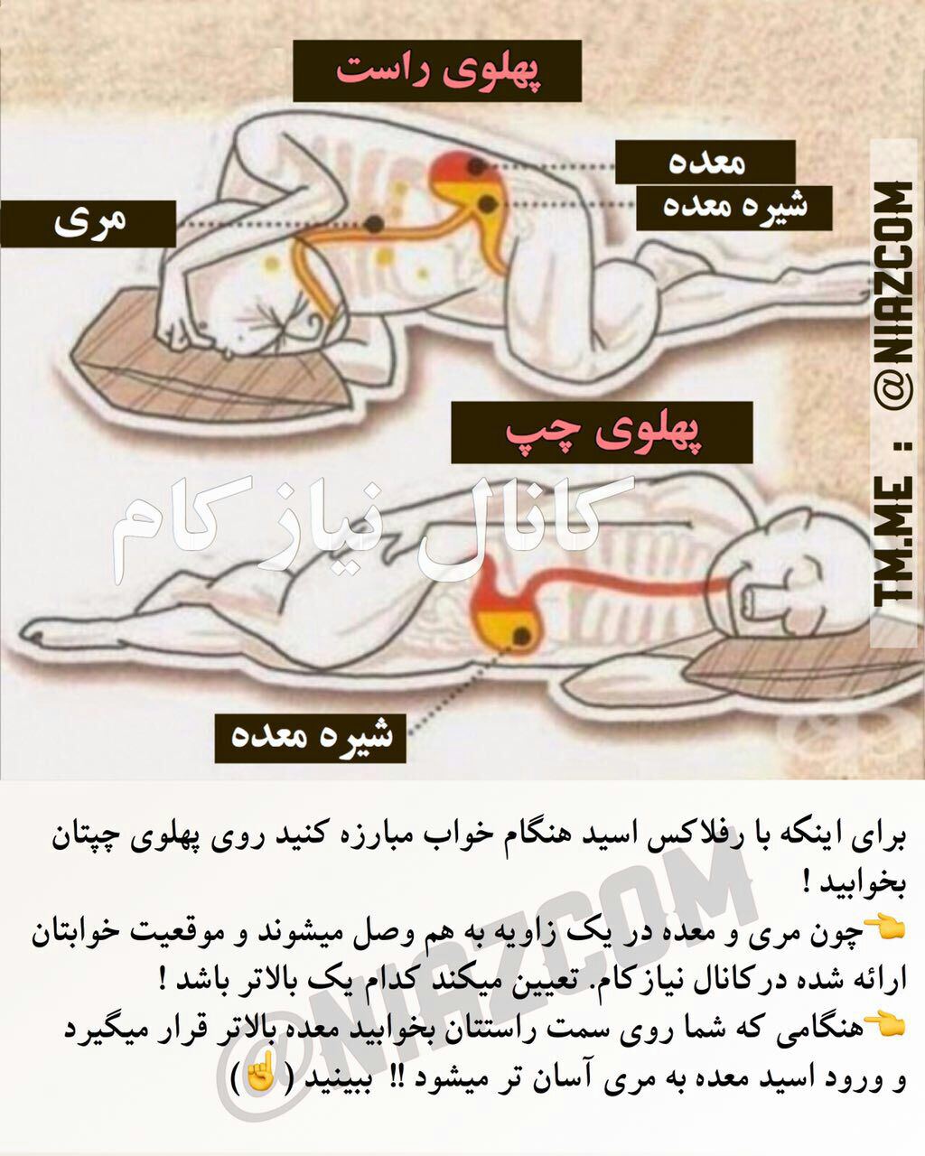 جلوگیری از رفلاکس معده