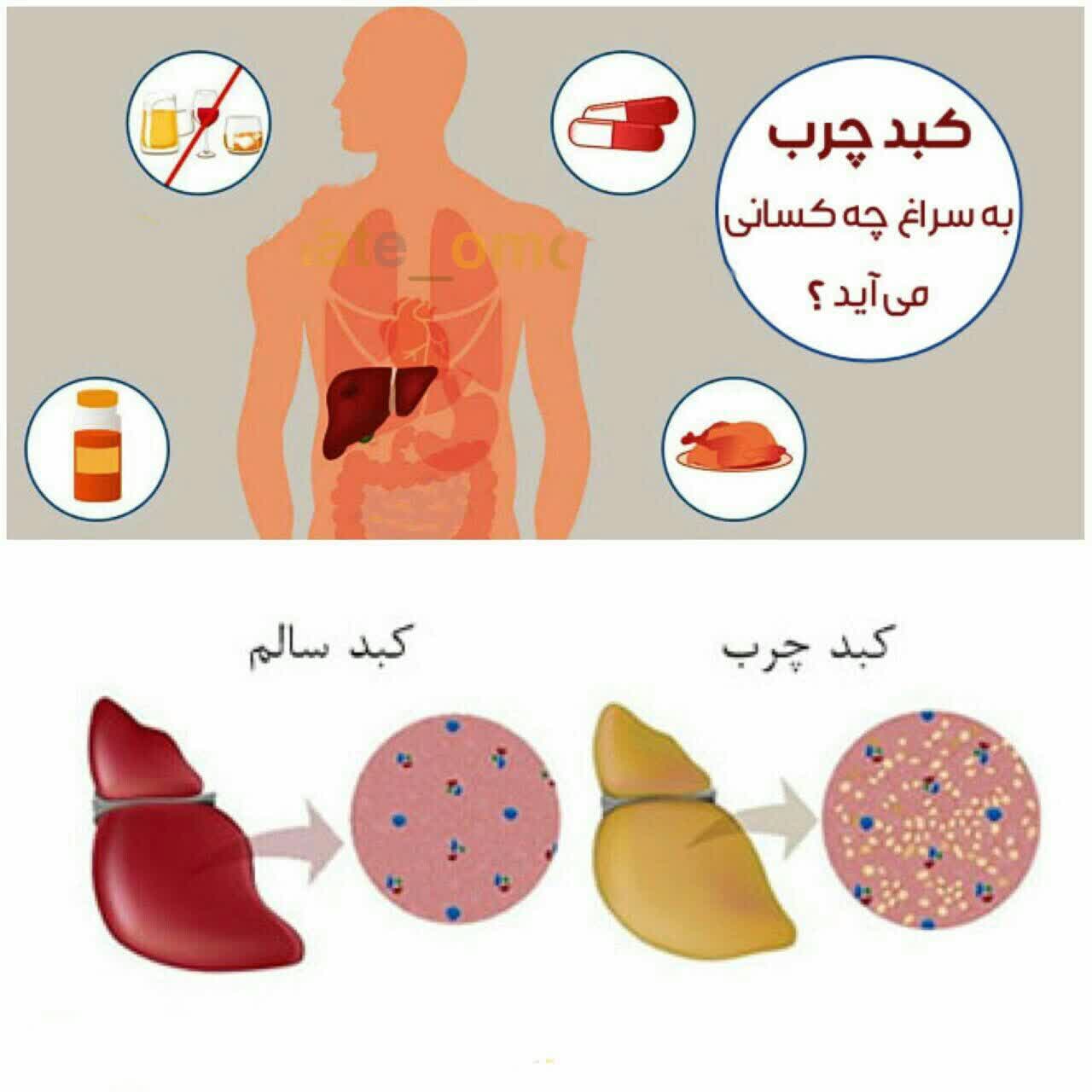علل از بين برنده كبد