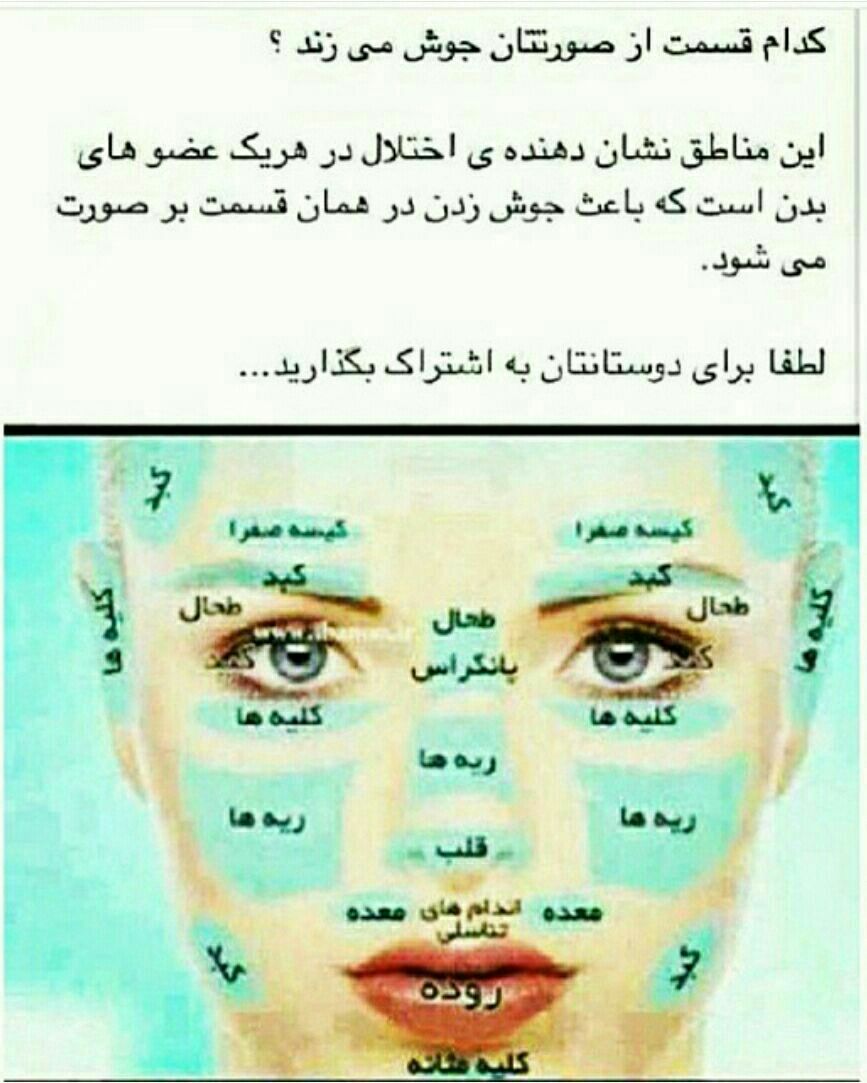 جوش صورت