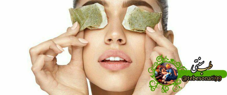 روش هایی برای از بین بردن گودی زیر چشم