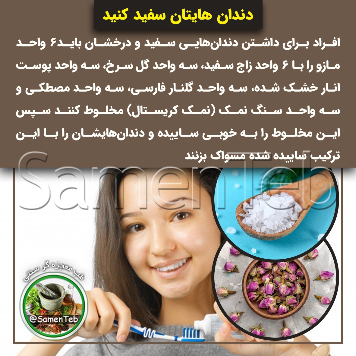 سفید کردن دندان ها