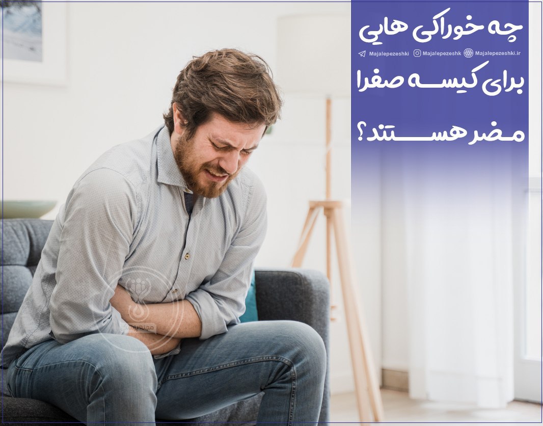 غذاهای مضر برای صفرا