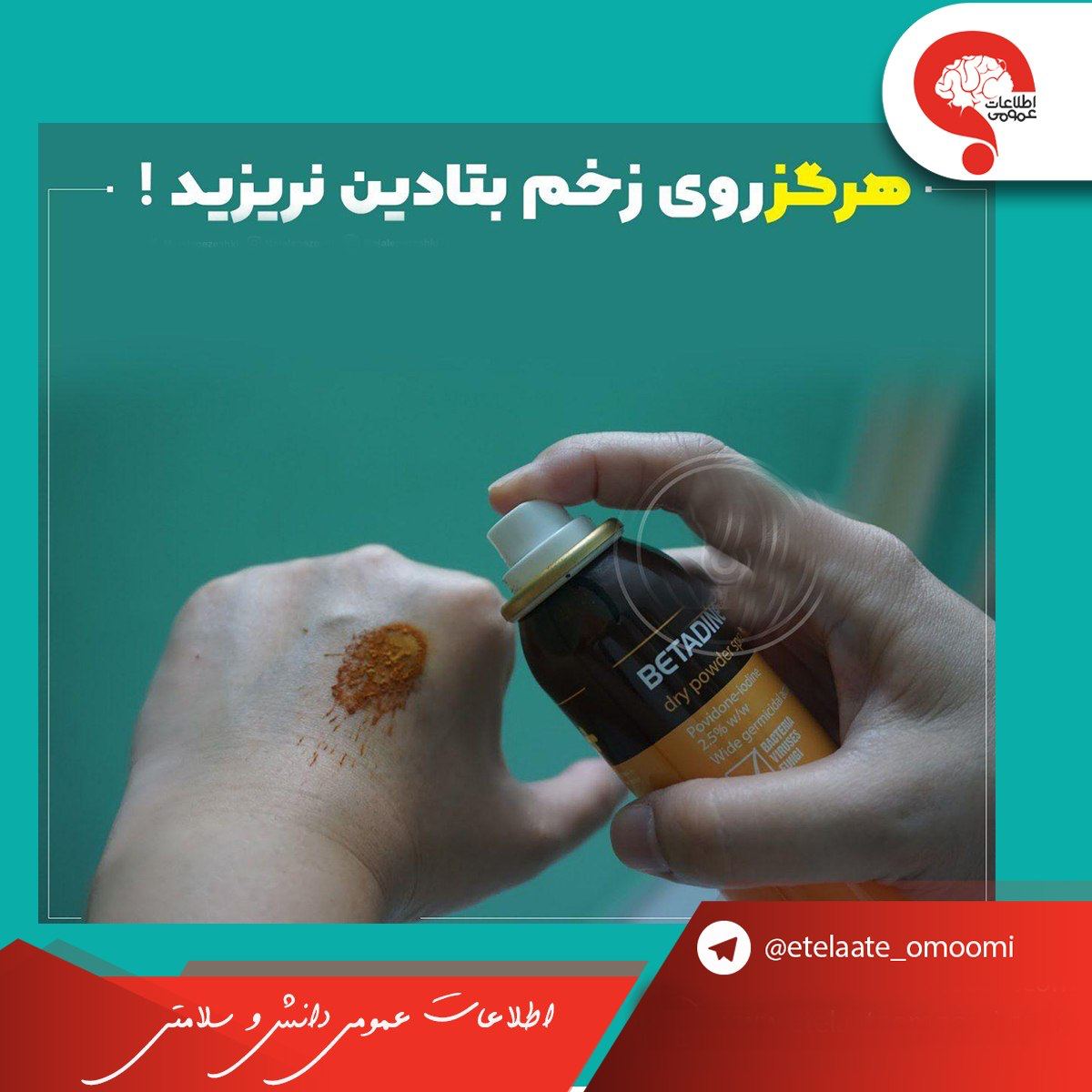 بر روی زخم ها بتادین نریزید