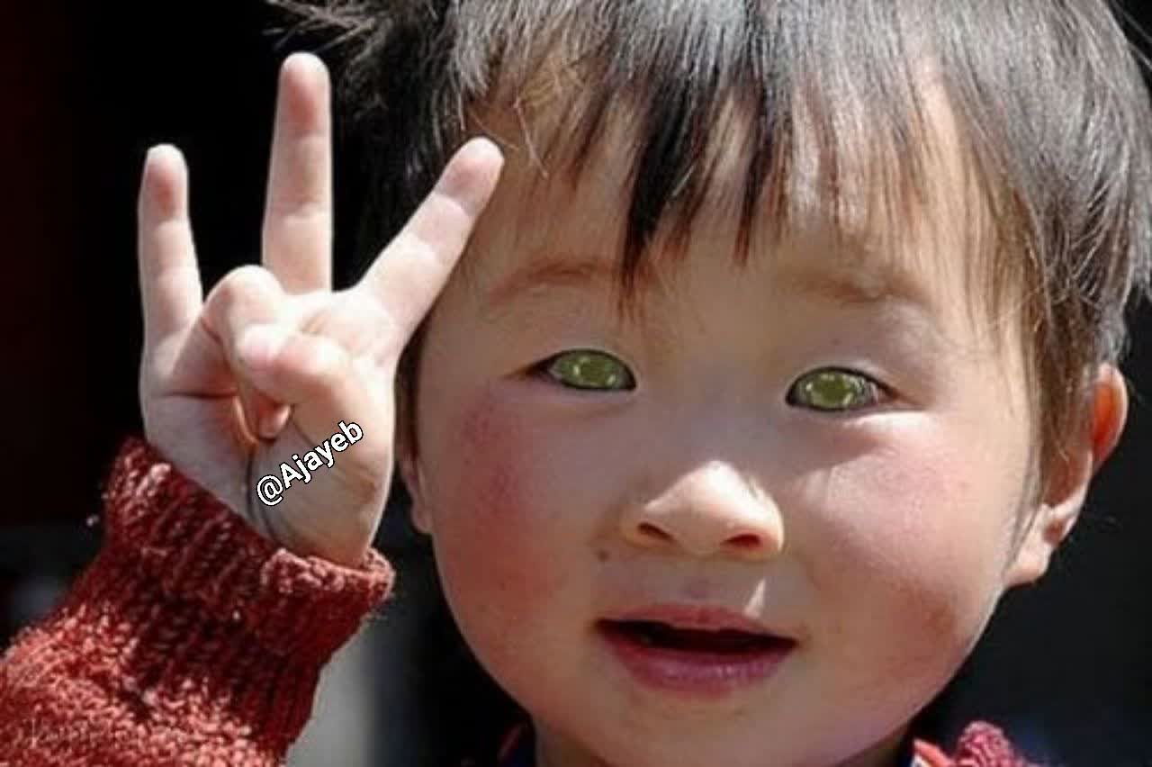 کودک چشم گربه‌ای