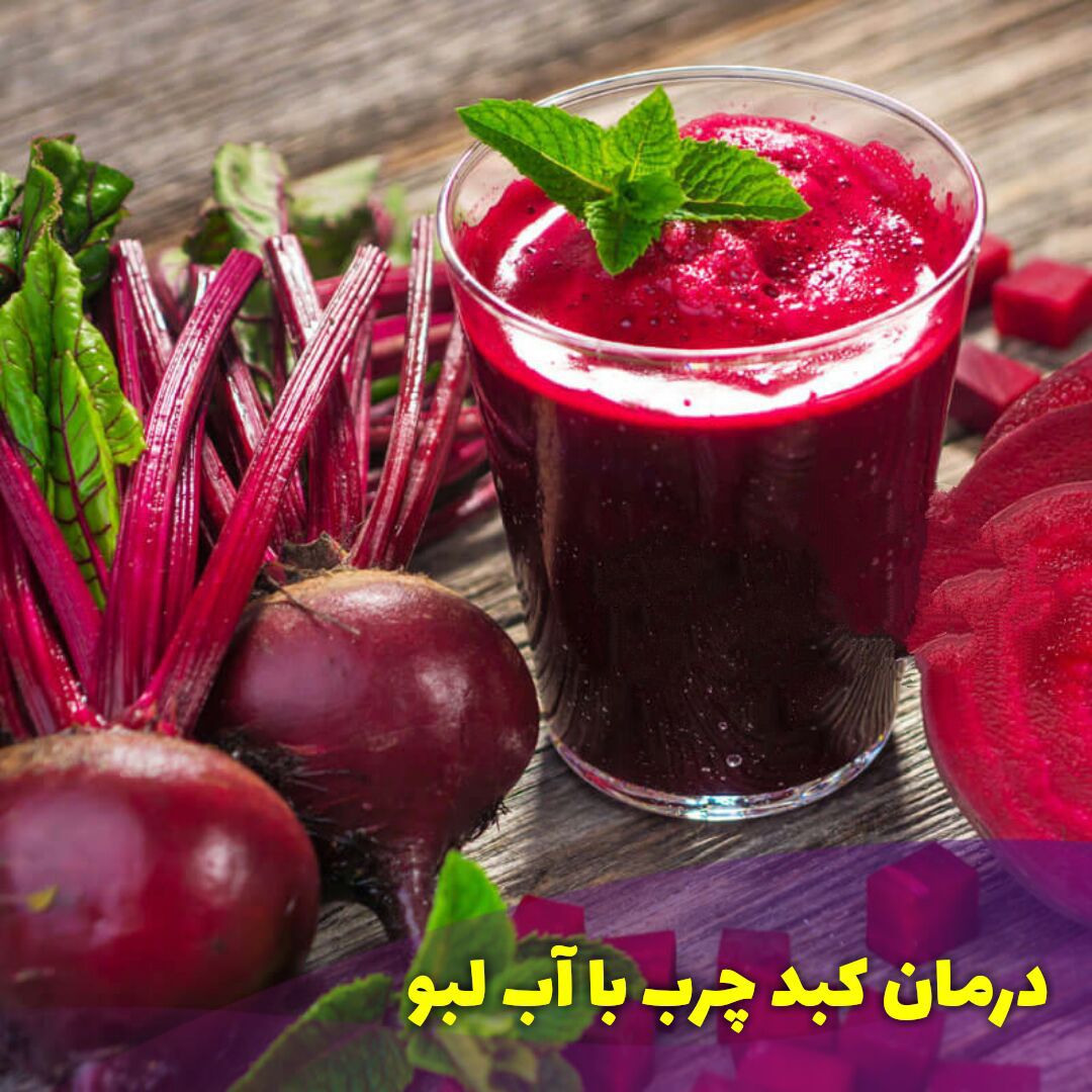 درمان کبد چرب