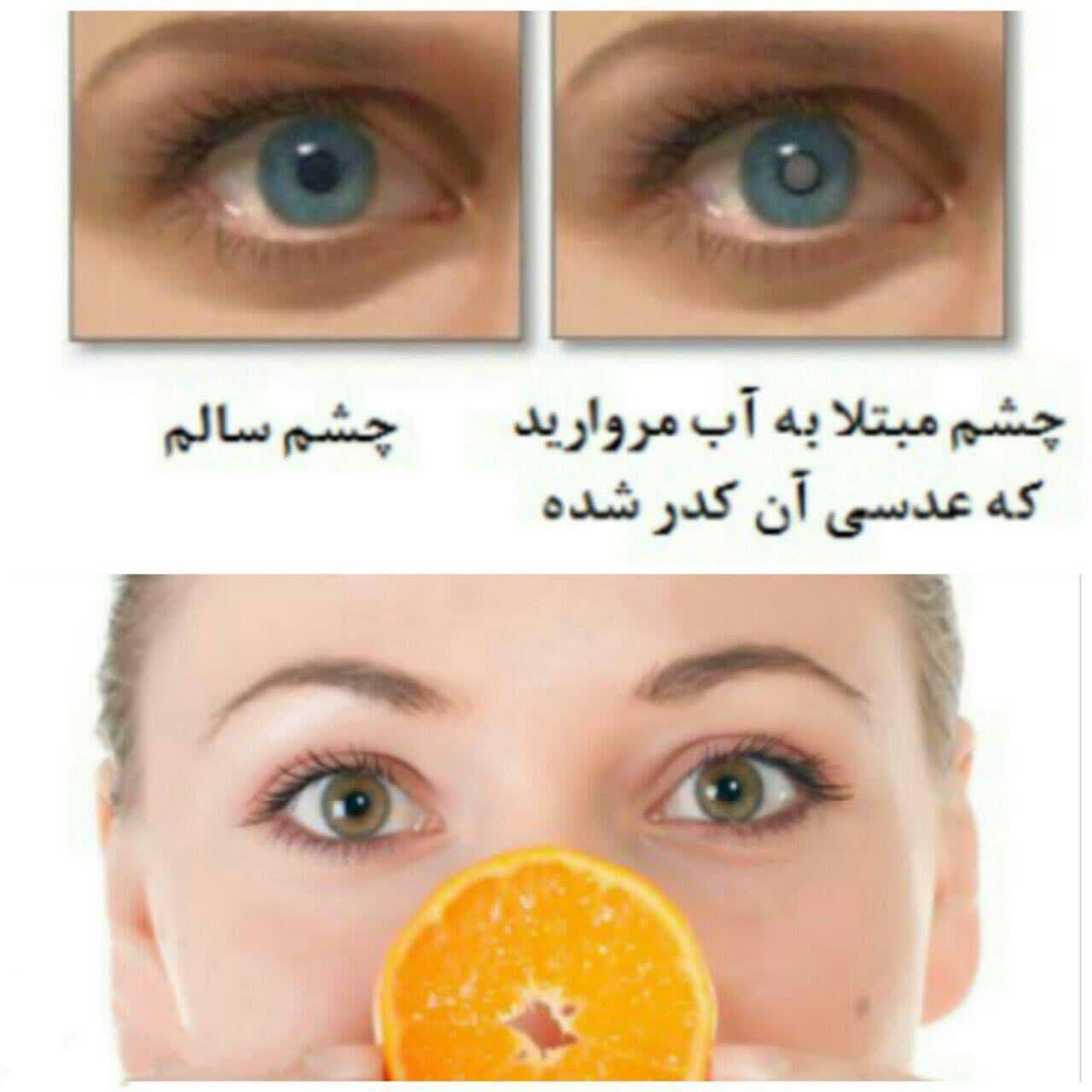 عدسی چشم انسان