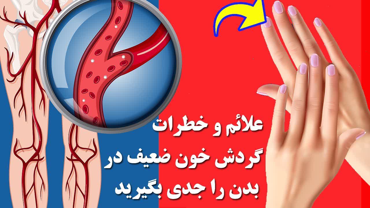 نشانه های گردش خون ضعیف