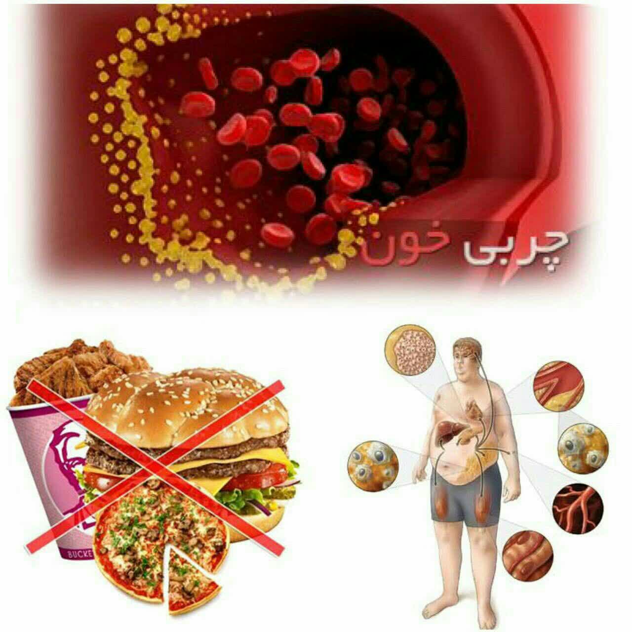 مهمترين علت بروز سرگيجه