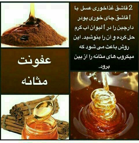 علایم عفونت مثانه