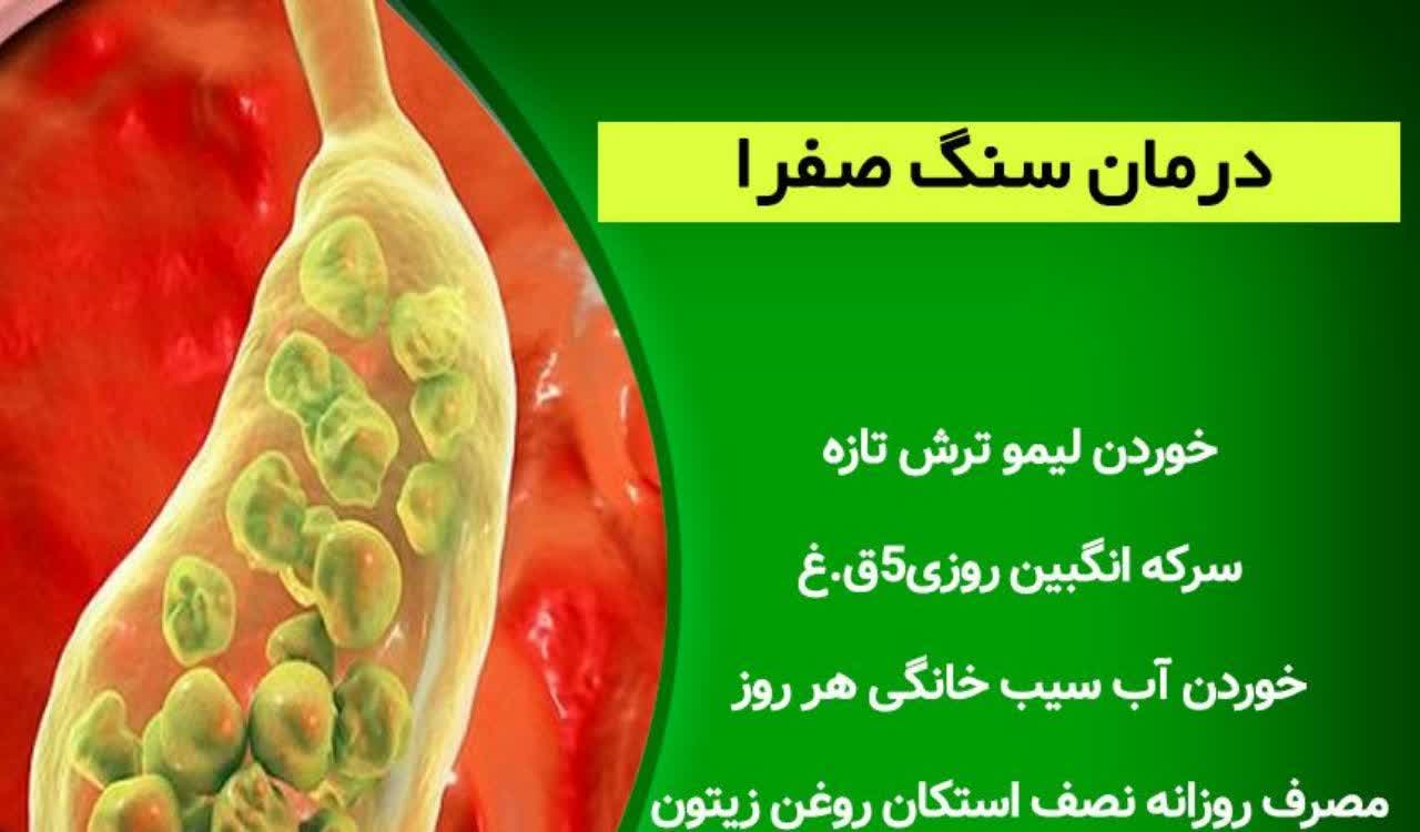 درمان سنگ صفرا