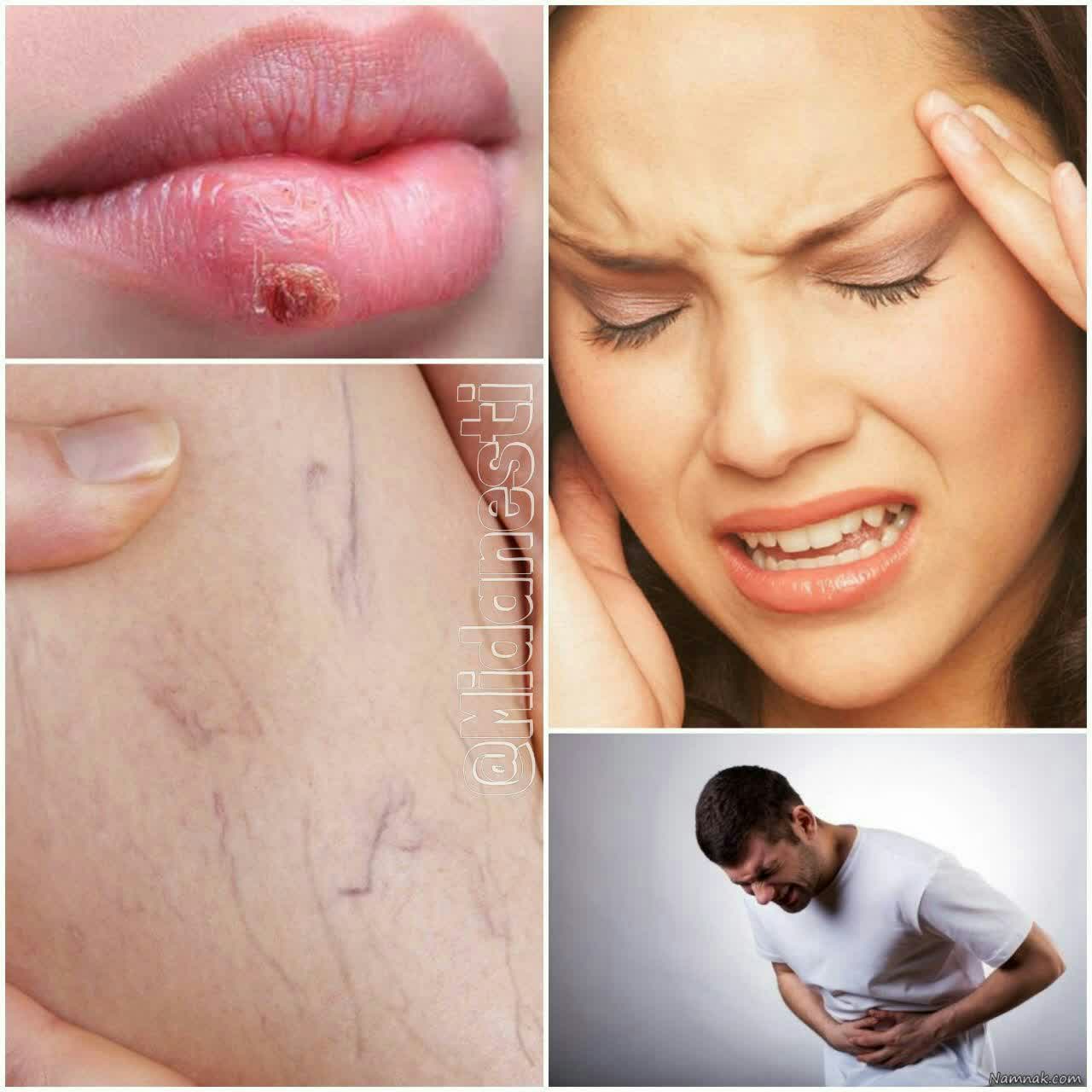 چی بخوریم برای چه مریضی ؟