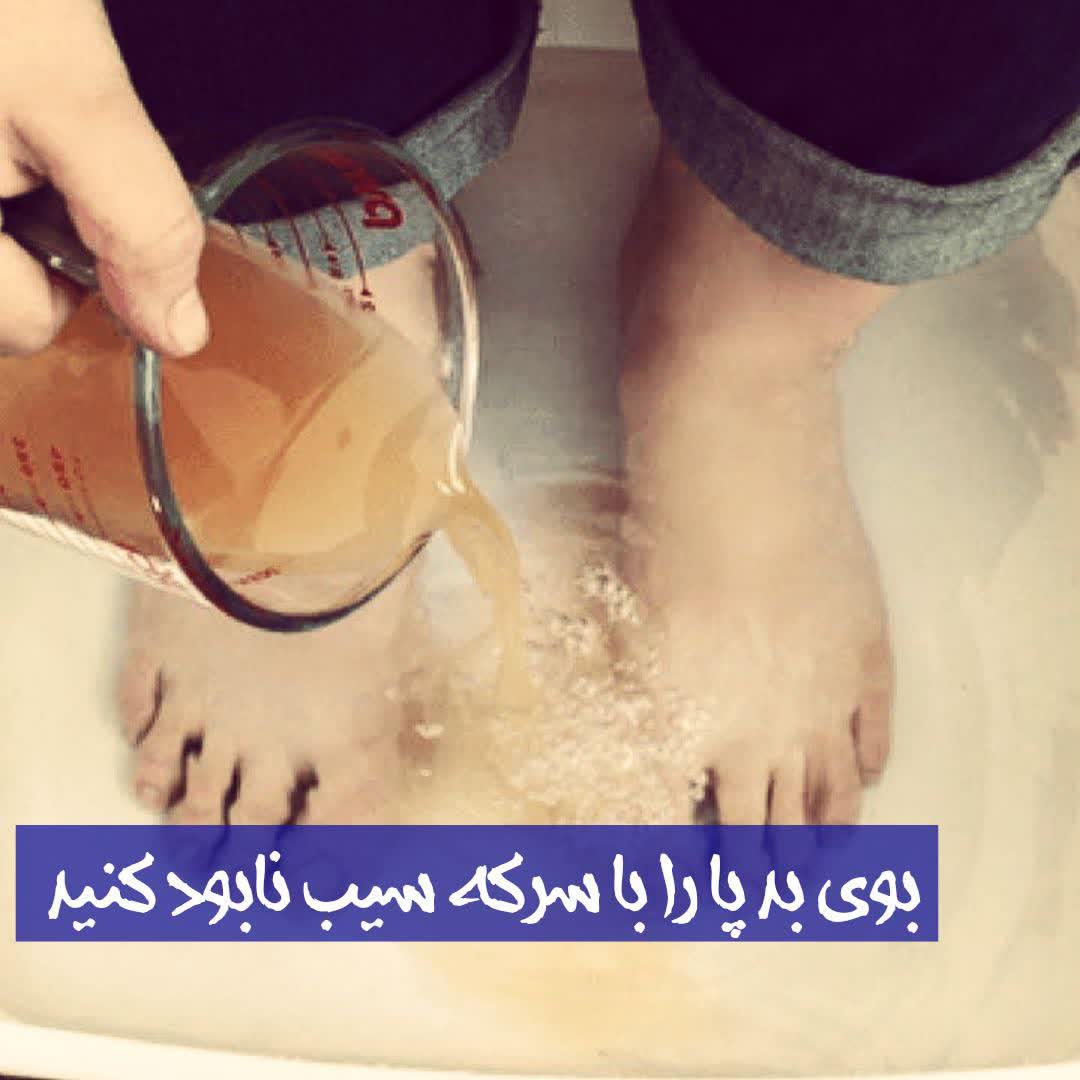 بوی بد پا را با سرکه سیب نابود کنید