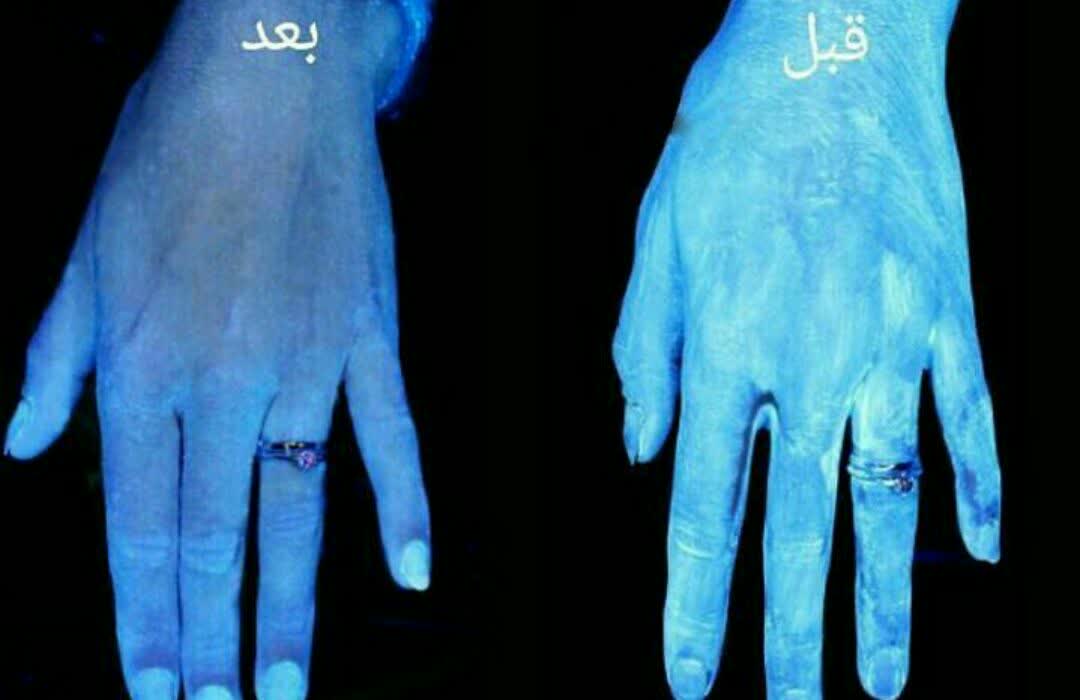 قبل و بعد از شستن با مواد شوینده 
