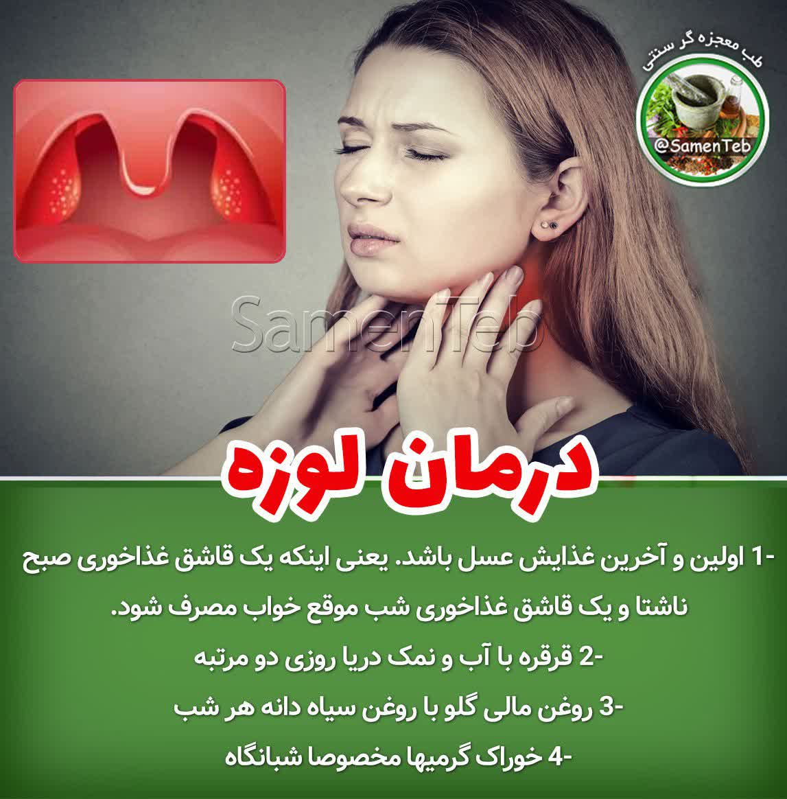 لوزه ناشی از سردی حلق و گلو است
