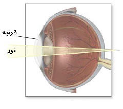 پیرچشمی