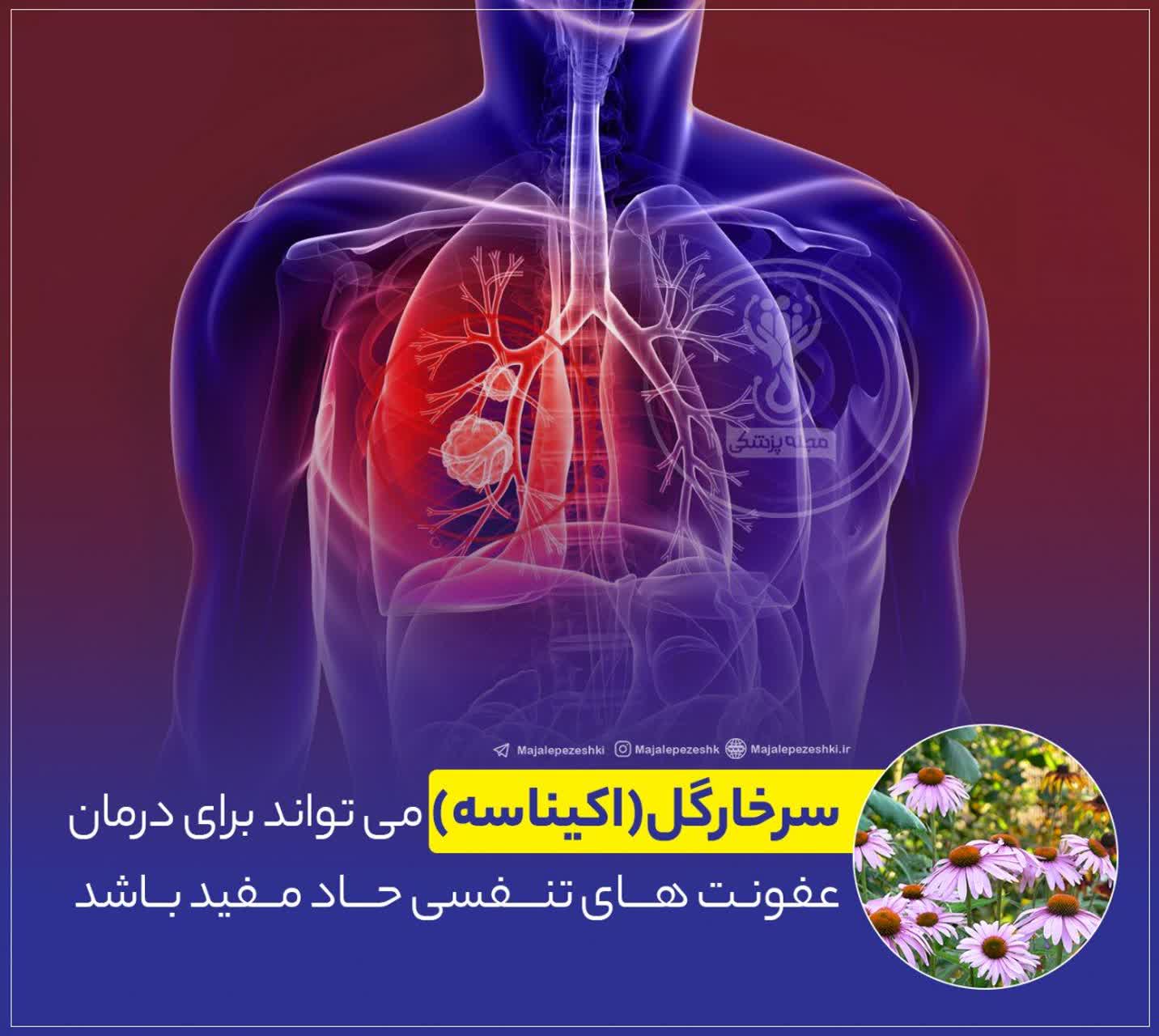 گیاهان تقویت کننده سیستم ایمنی 