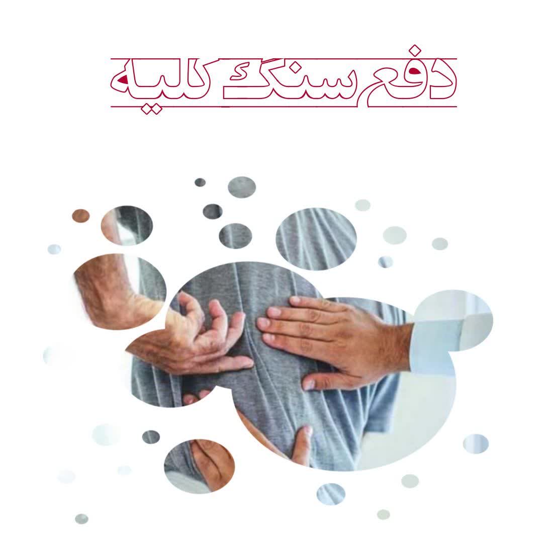 سنگ کلیه