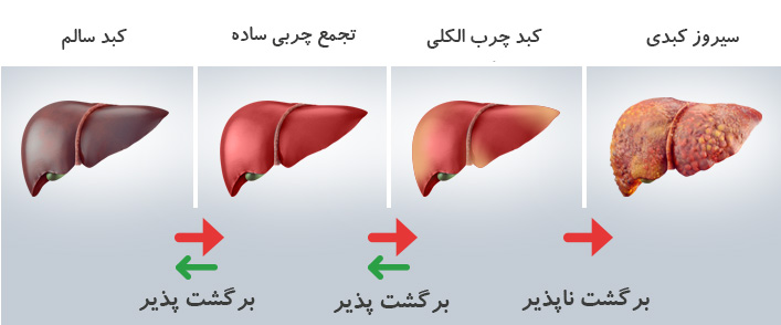 علایم کبد چرب