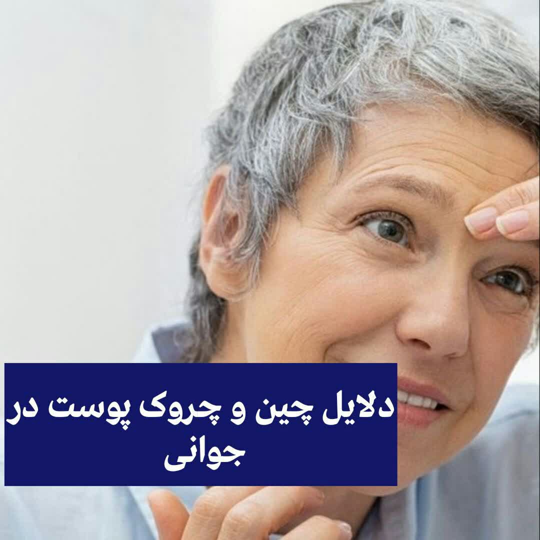 دلایل چین و چروک پوست در جوانی