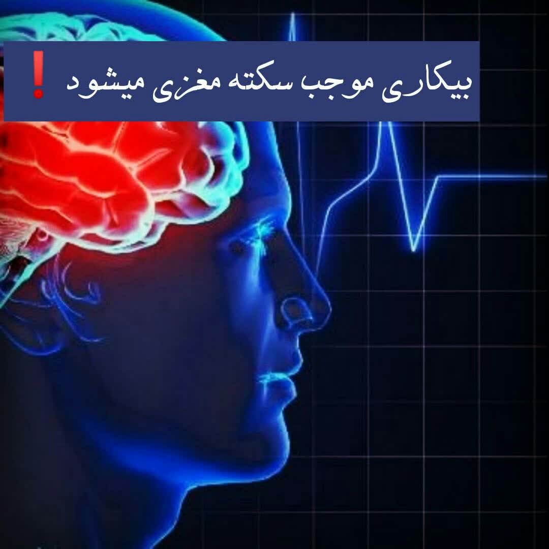 بیکاری موجب سکته مغزی میشود