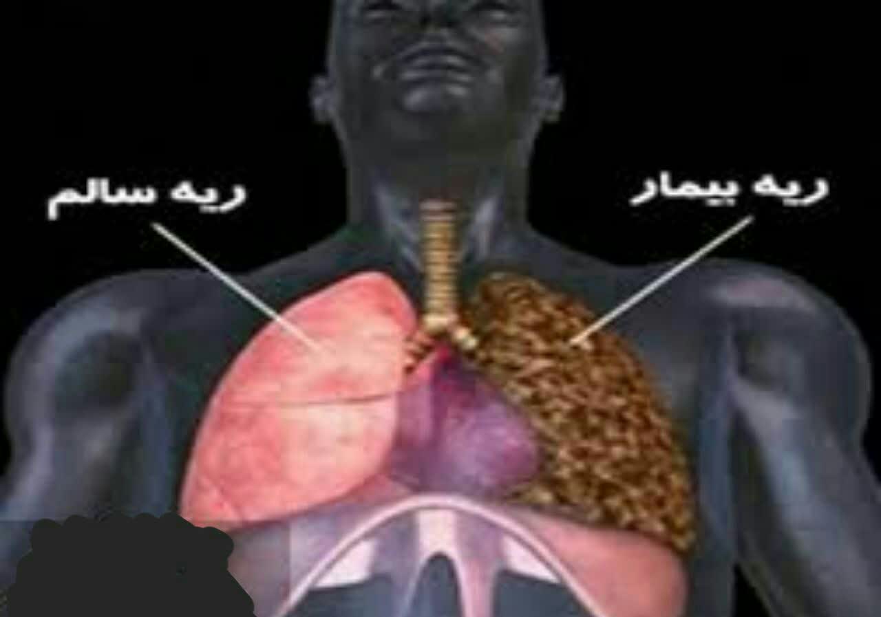 علائم از کار افتادن ریه‌ها