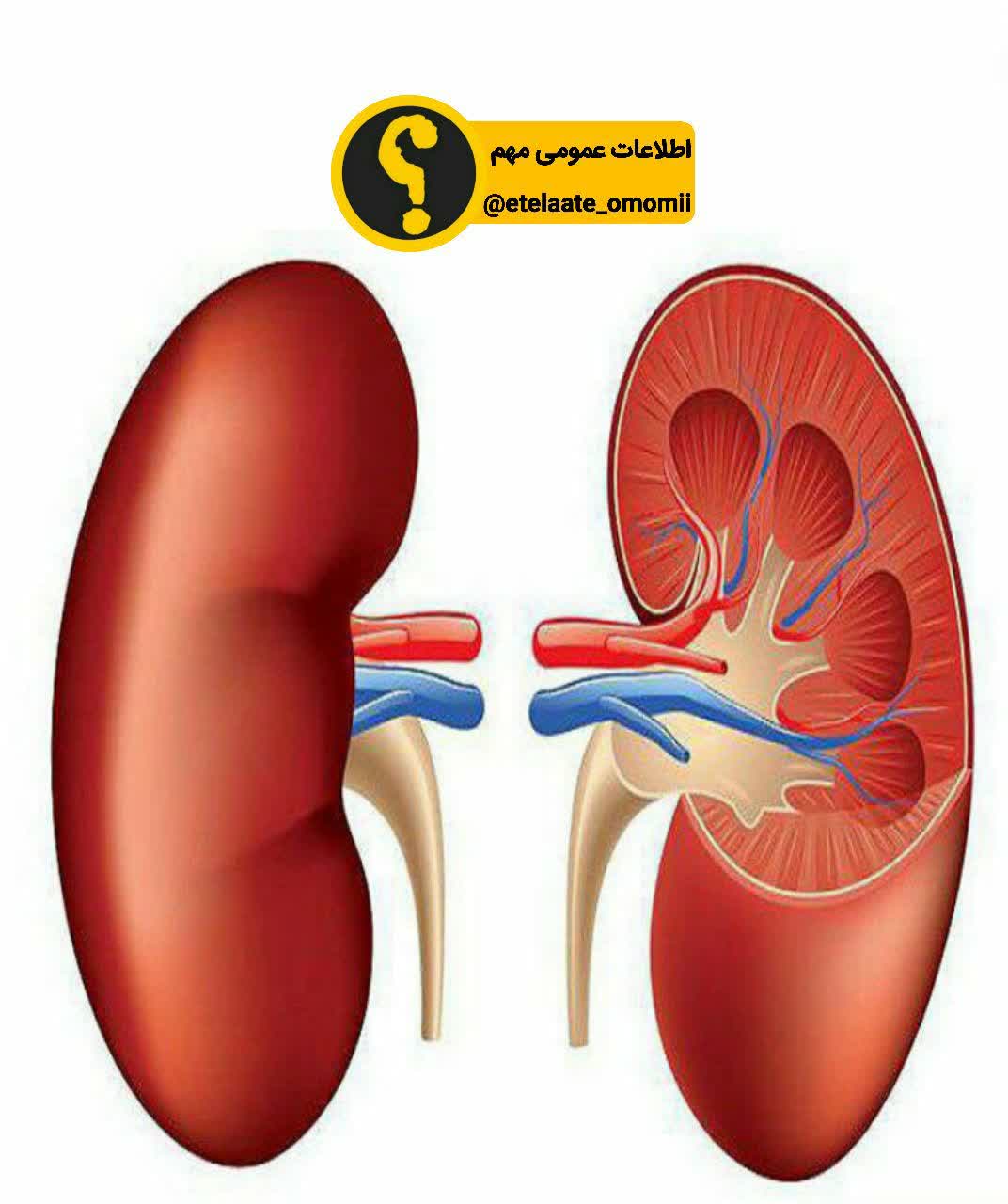 راه های دفع سنگ کلیه را میدانید