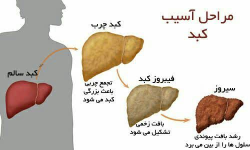 توصیه‌های غذایی کبد
