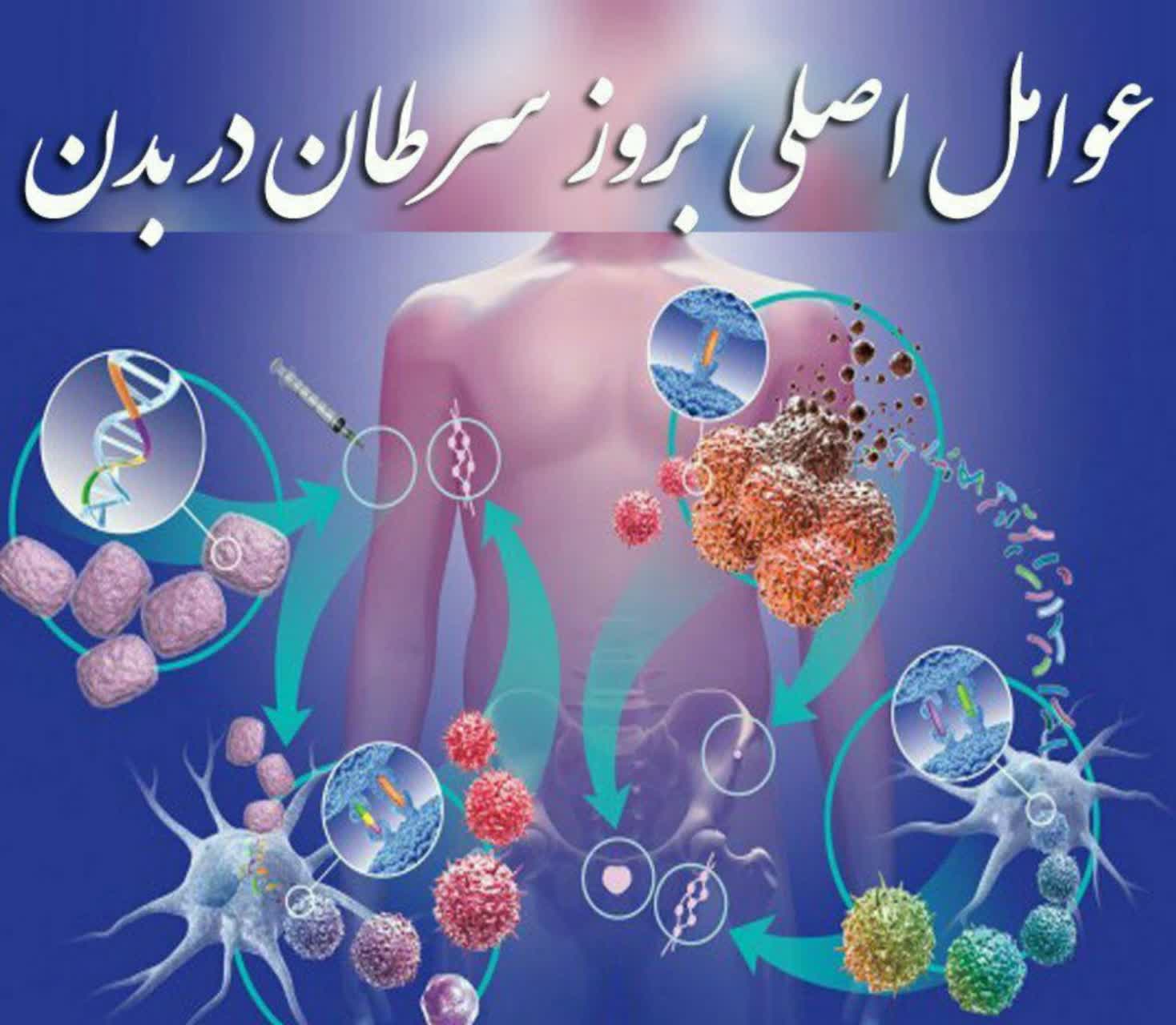 عوامل اصلی بروز سرطان 