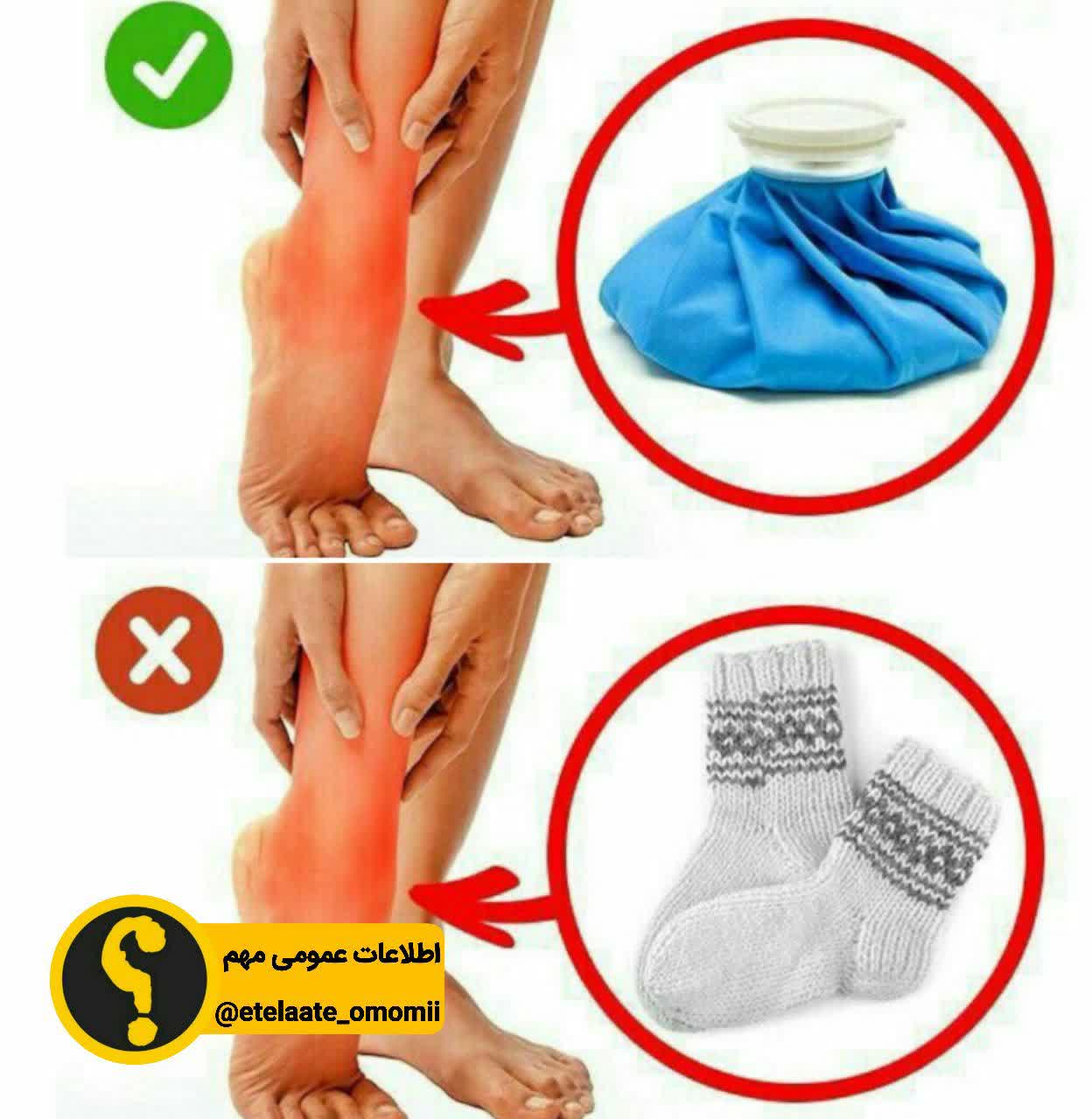 وقتی پا آسیب دید باید چیکار کنیم