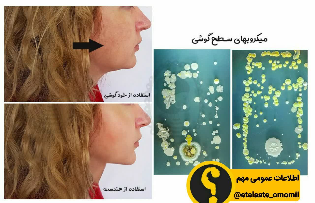 کثیفی صفحه گوشی