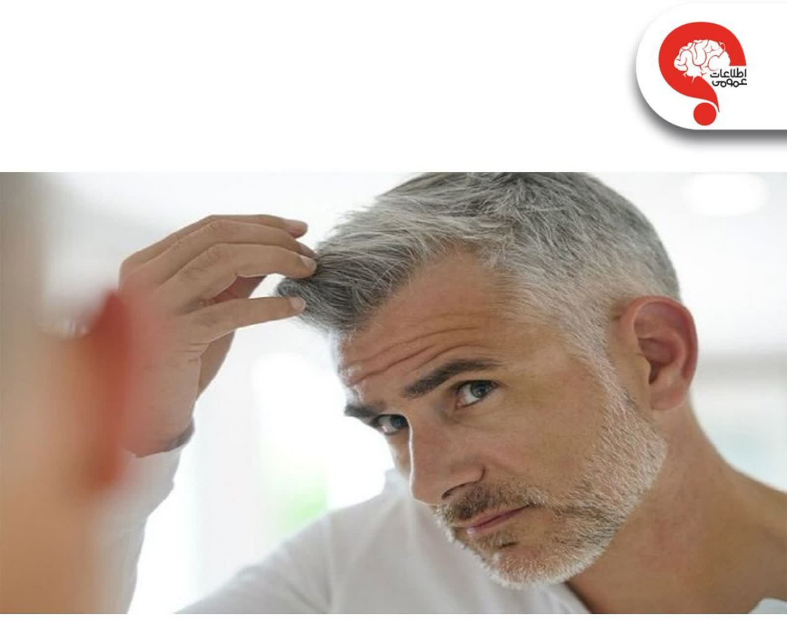 دلیل سفید شدن مو