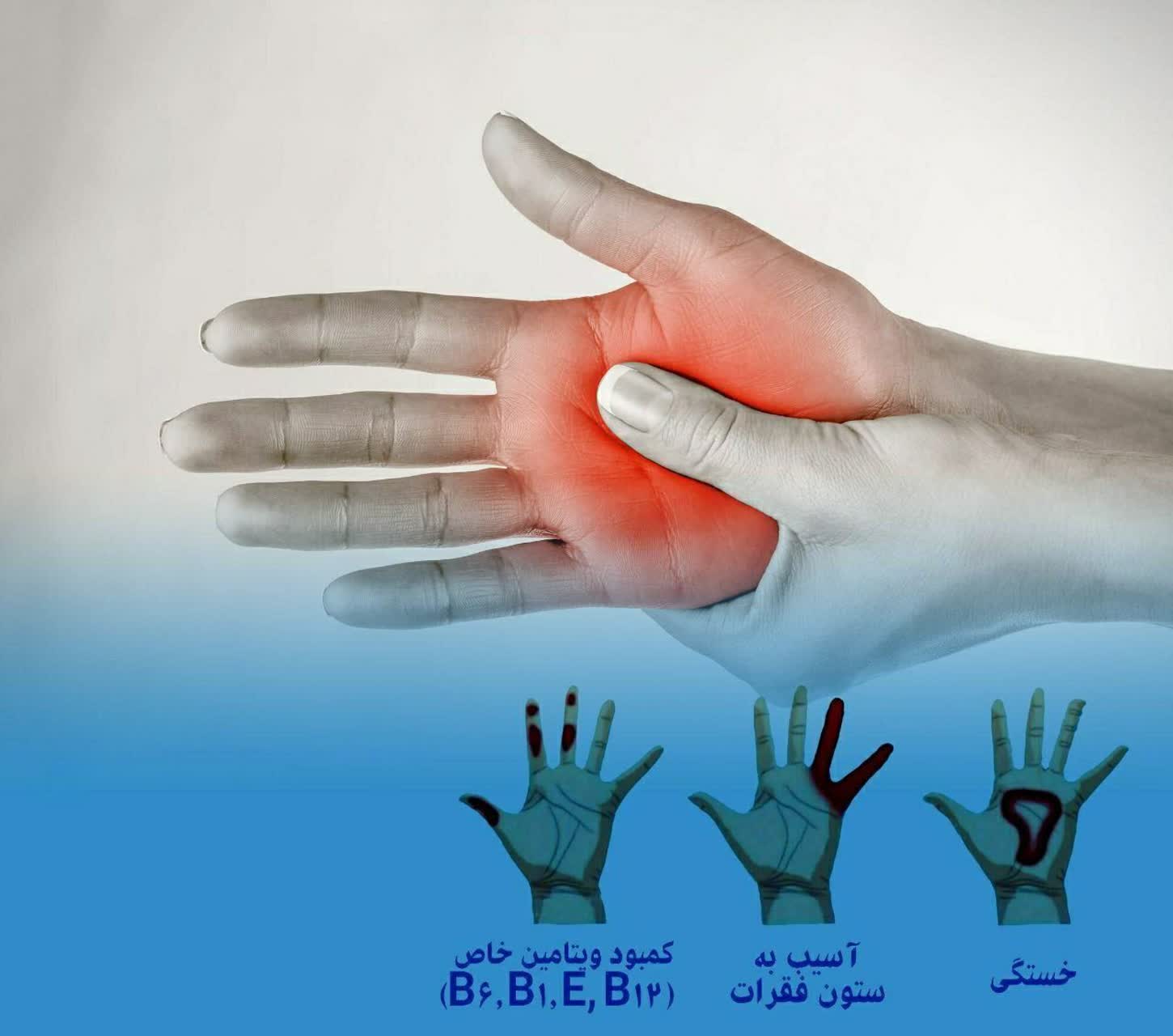 احساس سوزن سوزن شدن کف دست