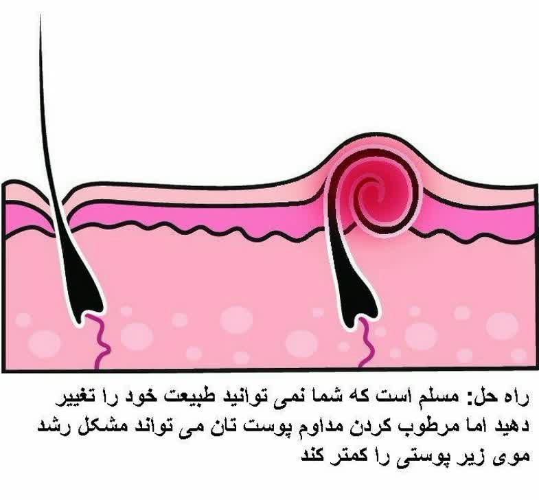 موهای بدن شما به طور طبیعی فر 