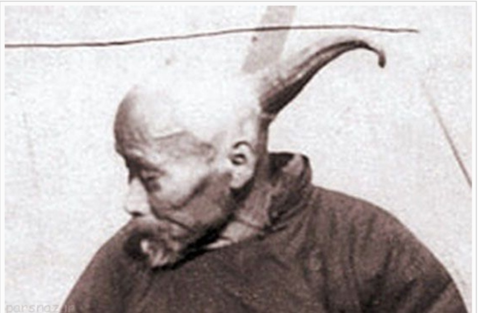 وانگ مرد تک شاخ