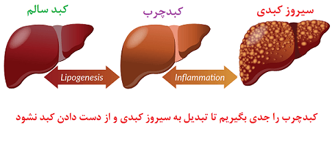 درمان کبد چرب با طب سنتی