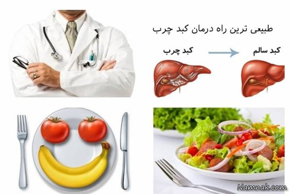 درمان کبد چرب