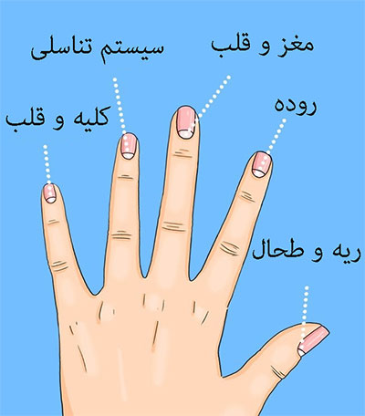 هلال سفید روی ناخن ها نشانه های چیست؟