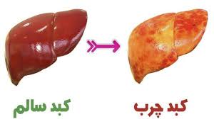 درمان کبد چرب با این چند میوه